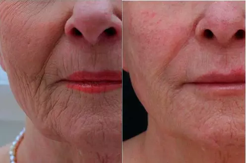 Renova Vitta 2025 - Nadir Alencar C, 59 Anos