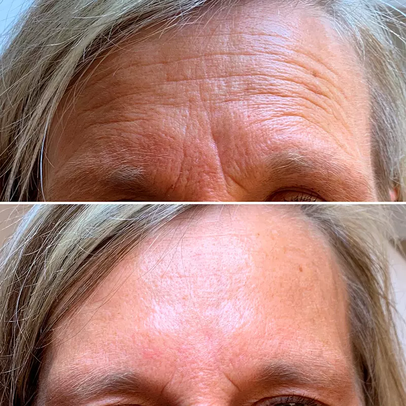 Renova Vitta - Roberta Oliveira